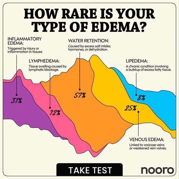 I took this 1-minute edema test…